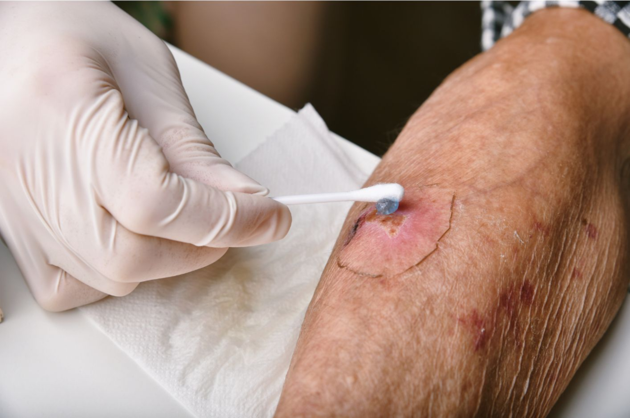 dekoratives Bild zur Seite 09.06.2026 | Palliative Wundbehandlung | Copyright: canva-gettyimages